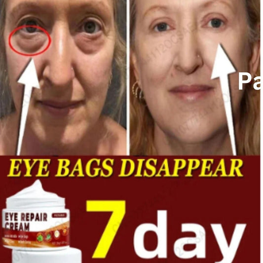 Eye Repair Cream